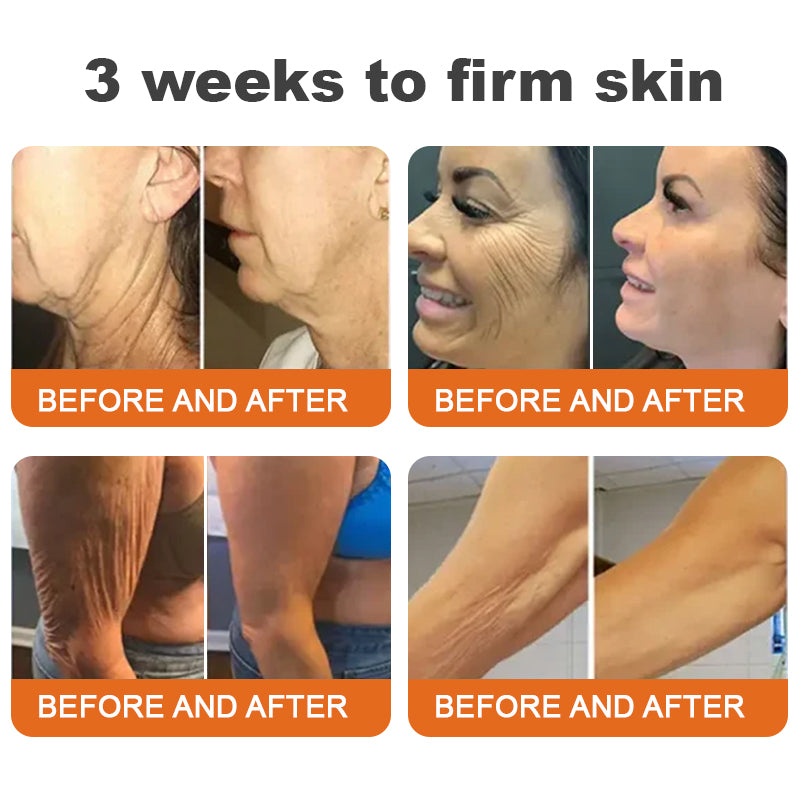 ✨💖Made and Shipped from USA✨Flysmus™ Botox Bee Venom Firming Serum Stick🔥LAST DAY 70% OFF